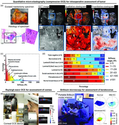 Demonstration Of Optical Elastography In Clinical Settings A And B Download Scientific