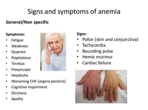 Anemia And Its Classification PPT