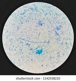 Smear Acidfast Bacilli Afb Stained Sputum Stock Photo 1142558210 ...