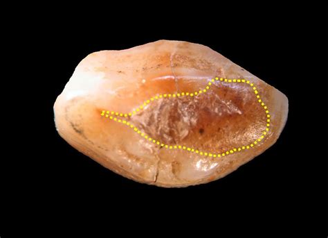 Beeswax Filling May Be Oldest Hint Of Dentistry Live Science
