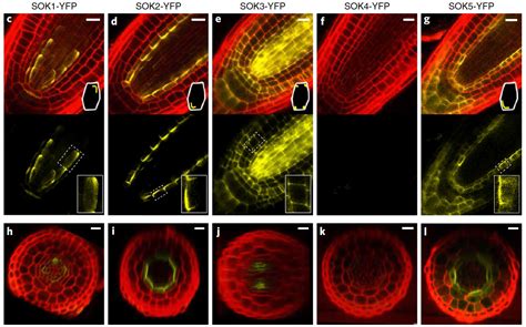 科学网—nature Plants：soseki蛋白影响拟南芥植株整体极性 郝兆东的博文