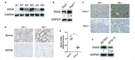 SNX9 Is Significantly Downregulated In ADPKD Patients And Pkd1