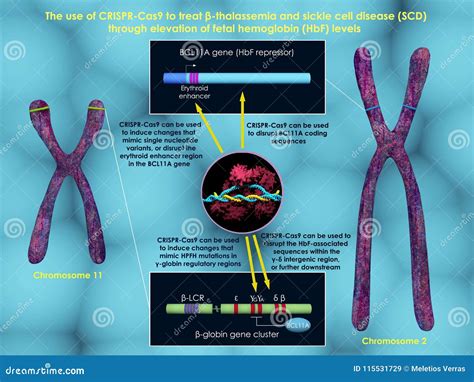 Crispr Cas9 To Treat Beta Thalassemia And Sickle Cell Disease Stock Illustration Illustration