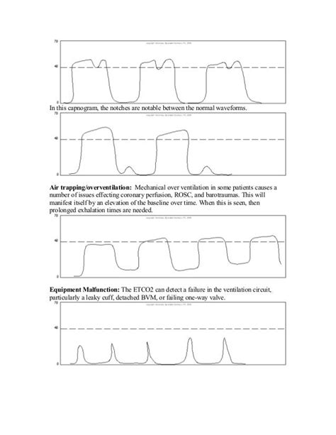 Capnography Overview For Le