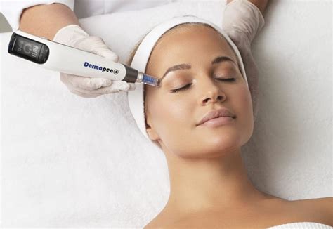 Microneedling DermapenWorld Dépil Skin beauty