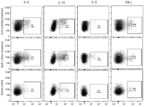 Episodic Angioedema With Eosinophilia Gleich Syndrome Is A