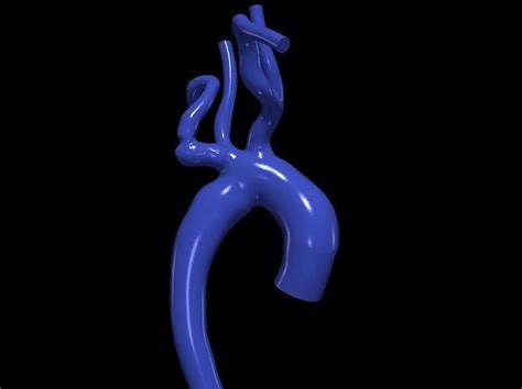 D Model Of Aorta D