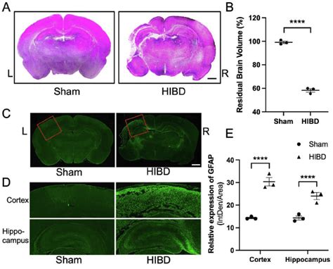 Ischemia And Hypoxia Both Cause Significant Brain Damage A Download Scientific Diagram