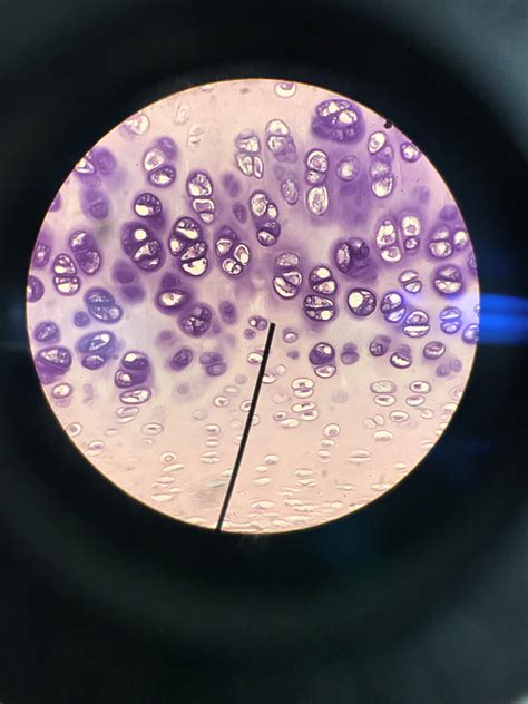 Hyaline cartilage of the Nose : r/Anatomy