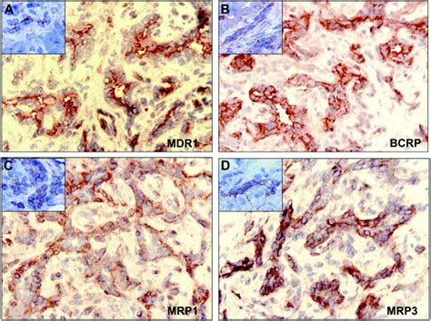 The Expression Of A MDR1 B BCRP C MRP1 And D MRP3 In CLC