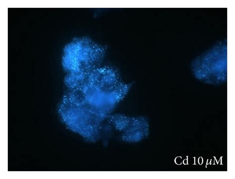 Microscopy Images Of Hepg Cells Loaded With M Of The Zinc Specific