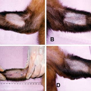 The Delayed Type Hypersensitivity DTH Skin Reactions In The Anterior