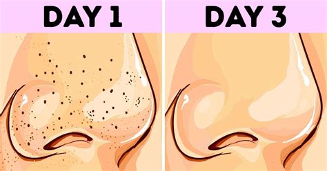 What Will Happen To Your Skin If You Stop Washing Your Face