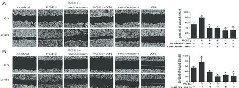 Effects Of PGE 2 Meloxicam And Xanthohumol On Migration Of M139 A