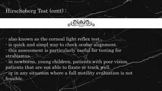 Management of tropia by prisms.pptx