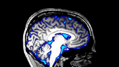 Surprising Facts About Cerebrospinal Fluid Csf Facts Net