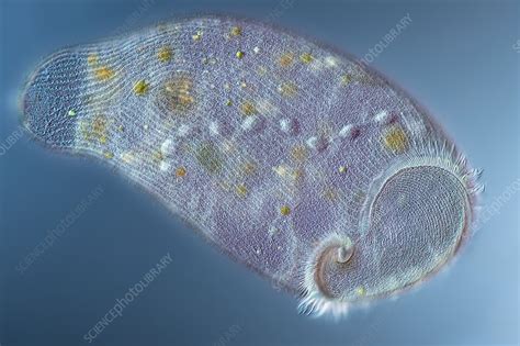 Stentor Protozoan Light Micrograph Stock Image C050 9365 Science