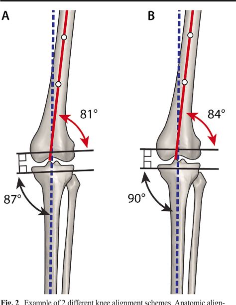 Coitus Alignment Technique