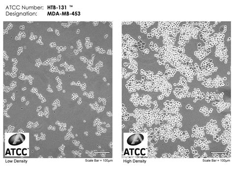 Mda Mb 453细胞atcc Htb 131细胞 Mdamb453人乳腺癌细胞株购买价格、培养基、培养条件、细胞图片、特征等基本信息生物风