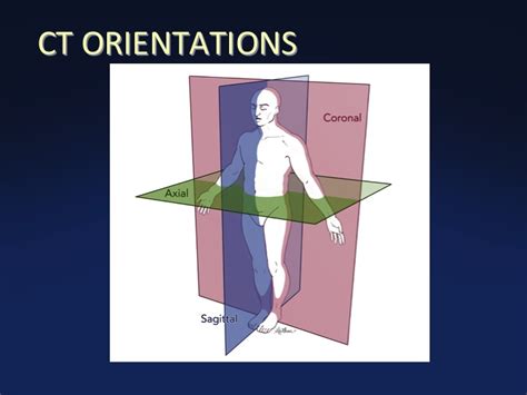 Cross Sectional Anatomy Of The Body Mdct Atlas Ct Scanning