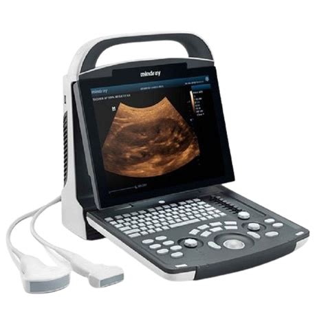 Portable Ultrasound - Modernquip Medical Supplies