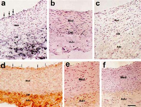 A In Situ Hybridization Using An 35 S Labeled Anti Sense Rna Probe For