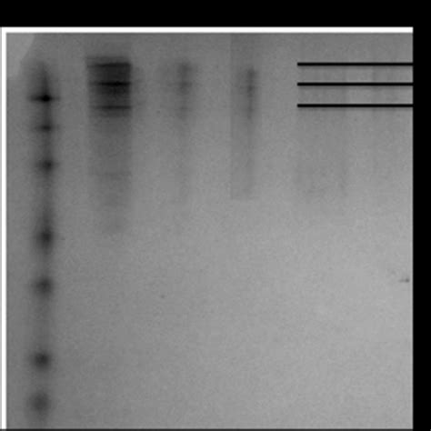 SDS PAGE Pattern Of Gelatine Extracted From Treatment 1 T1 Treatment