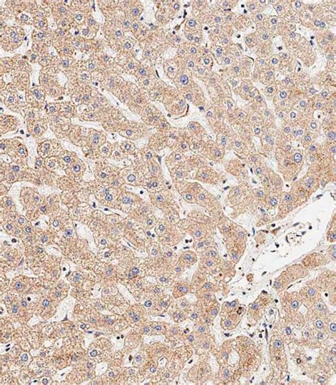 APG8b MAP1LC3B Antibody N Term T29 Affinity Purified Rabbit