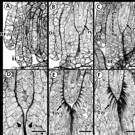 Ovule In Fouquieria Fasciculata A Mature Ovule B Bitegmic Ovule
