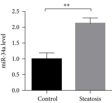 Characteristics of circRNA 0046367 miR 34a PPARα regulatory system in