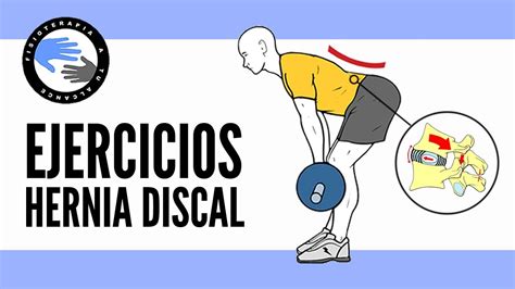 Hernia Discal Lumbar Programa De Ejercicios Para La Fase Avanzada