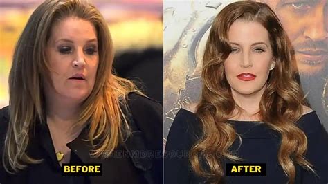 Lisa Marie Presley Weight Gain. Weight Loss, Bariatric Surgery, Death ...