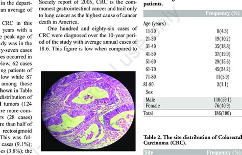 Handex40 Section Of Adenocarcinoma Showing Infiltrating Malignant Download Scientific Diagram