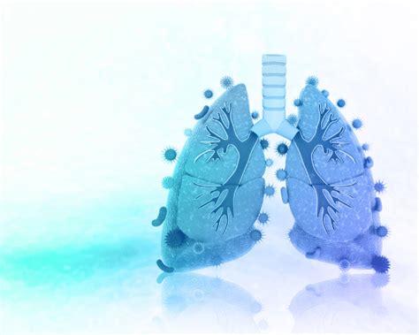 Lung Infection Symptoms Causes And Treatment Sprint Medical