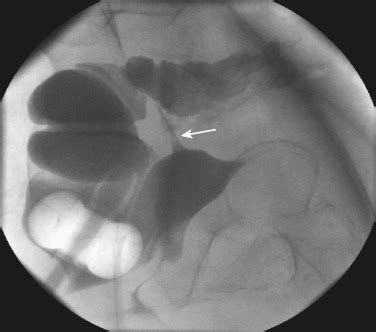 Colon Imaging Conventional Imaging And Computed Tomography Clinical Tree