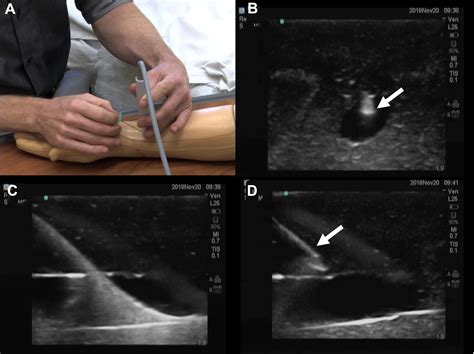 Better With Ultrasound CHEST