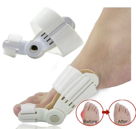 Hallux Valgus Ortics Gros Orteil Correcteur Traitement Des Pieds