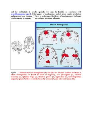 Topic Of The Month Radiological Pathology Of Meningiomas Pdf