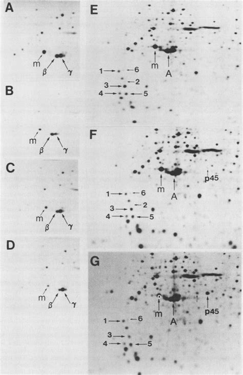 Autoradiograms Of 35s Methionine Labeled Polypeptides Separated By