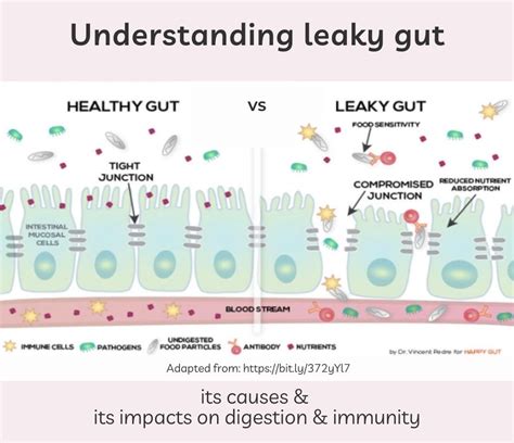 Understanding leaky gut | Tira's Corner