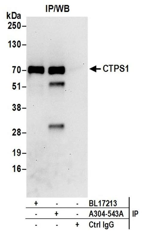 Ctps1 Polyclonal Antibody A304 543a