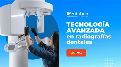 Tecnolog A De Vanguardia En Cl Nica De Radiograf As Dentales Dental