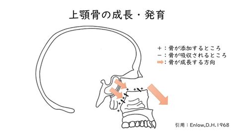 矯正治療と上顎骨・下顎骨の成長発育｜doctorʼs Blog｜新浦安カタヤマ矯正歯科｜新浦安駅直結｜矯正歯科の専門医院