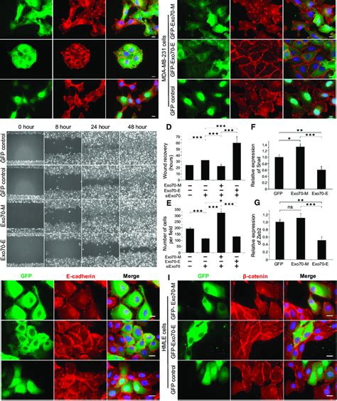 Expression Of Specific Exo70 Isoforms Induces MET Or EMT Like