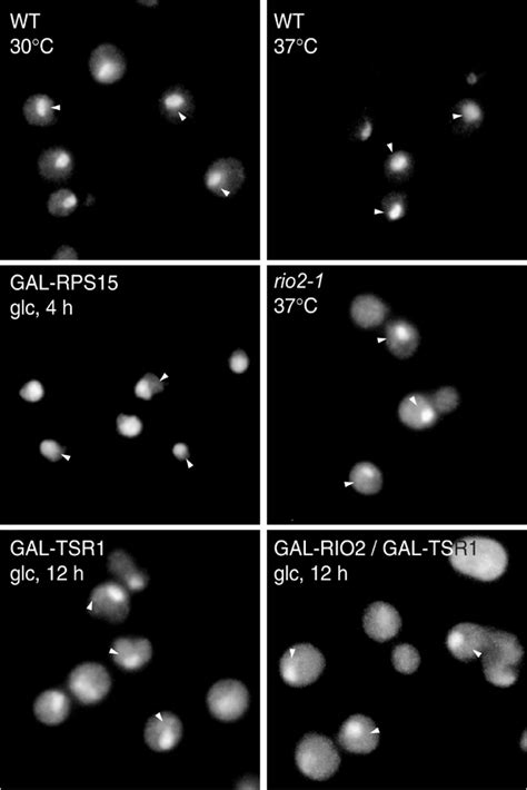 The Ribosomal Protein Rps15p Is Required For Nuclear Exit Of The 40s