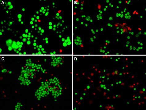 Fluorescence Micrographs Of Mcf Cells Treated With Different