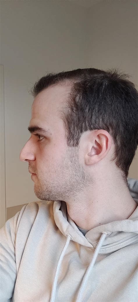 Should I Go Full Shave Feeling Pretty Insecure After Shaving Off My