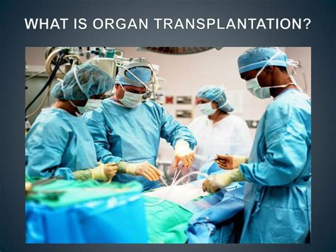 Ppt Transplantology Powerpoint Presentation Free Download Id5334225