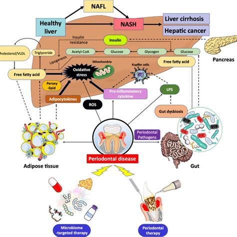 Mechanisms By Which Periodontal Disease Affects The Pathogenesis Of