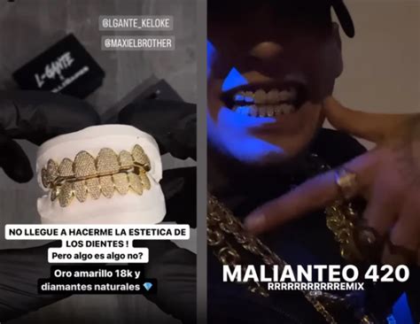 L Gante Mostr Su Nueva Dentadura De Oro